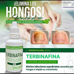 Gotas de TERBINAFINA para los hongos en las uñas.